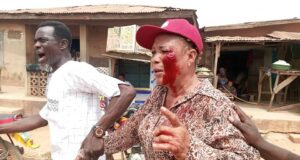 Many Injured as Violence Erupts at APC Ward Congress in Oluyole